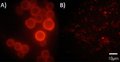 Sonda molecular para diagnóstico de histoplasmose