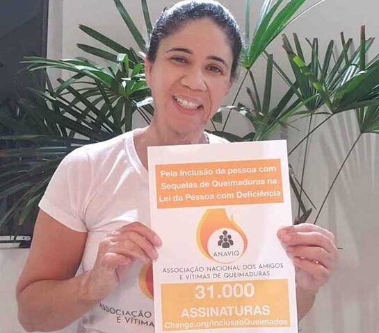 Vítima de queimaduras, Alexandra Bilar lançou campanha pela aprovação do PL (Foto: Arquivo pessoal) - Gente de Opinião