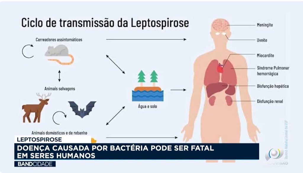 Leptospirose: doença causada por bactéria pode ser fatal e seres humanos - Gente de Opinião