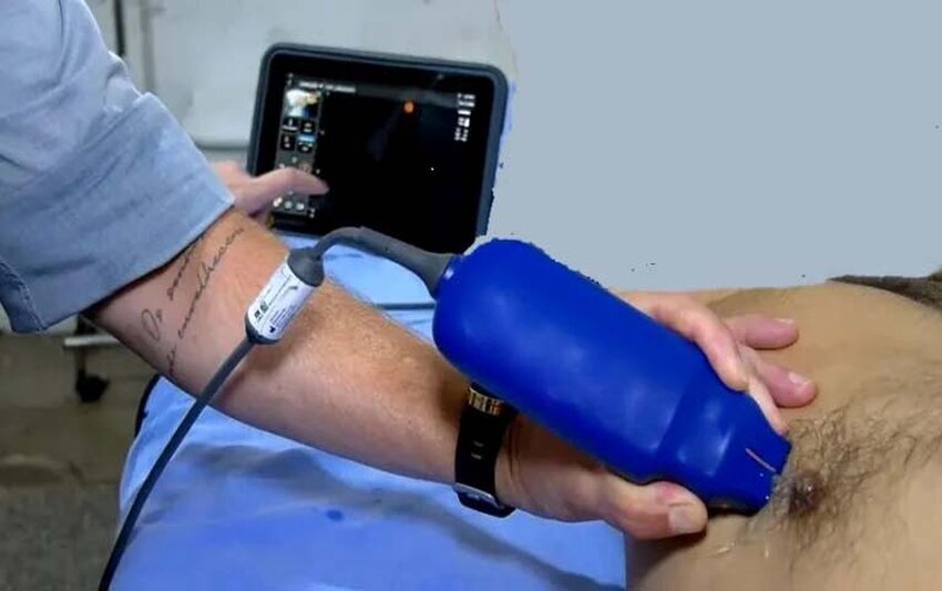 Equipamentos com tecnologia de IA agilizam exames no Pronto-Socorro João Paulo II, em Porto Velho